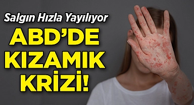 ABD'de Kızamık Krizi: Salgın Hızla Yayılıyor!