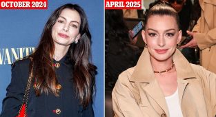 Anne Hathaway sparks plastic surgery speculation with taut complexion