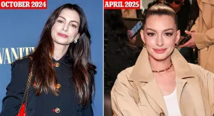 Anne Hathaway sparks plastic surgery speculation with taut complexion