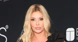 Brandi Glanville slams doctors over facial parasite crisis