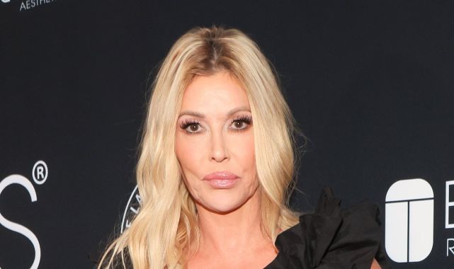 Brandi Glanville slams doctors over facial parasite crisis