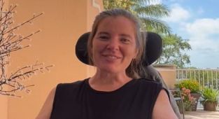 Common leg injury was only sign of motor neurone disease in 36 yr-old