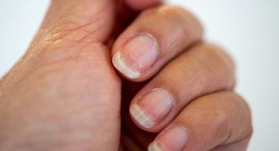 Dermatologist reveals SECRET health problems your nails are hiding