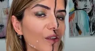 Doctor gets Botox on half her face - can you spot the natural side?