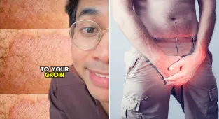 Doctor warns you're putting pants on WRONG - risking crotch infection
