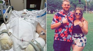 Freak s'mores accident puts dad-of-two, 25, in deep hospital coma