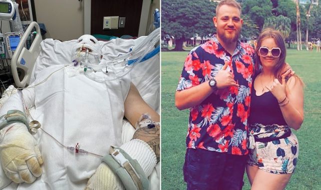 Freak s'mores accident puts dad-of-two, 25, in deep hospital coma