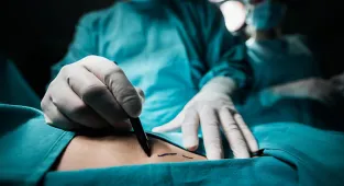 I fix botched plastic surgeries... here are the procedures to avoid