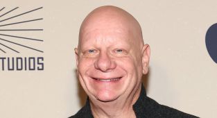 Jeff Ross hospitalized for allergic reaction to surprising food item