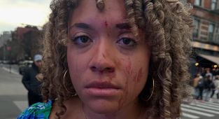 Pro-life activist punched in the face by enraged woman over abortion