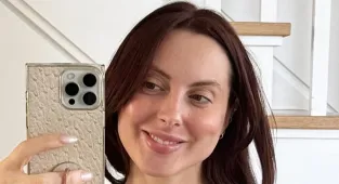 Susan Sarandon's daughter gets candid about plastic surgery journey