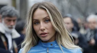 TikToker Alix Earle reveals acne as she gives her skin a 'break'