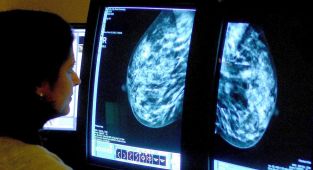 Warning over cooking staple that's linked to aggressive breast cancer