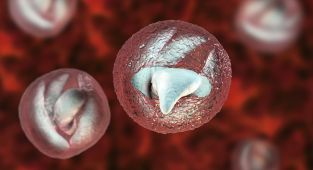 Warning over gruesome parasite causing 'bowel cancer-like' symptoms