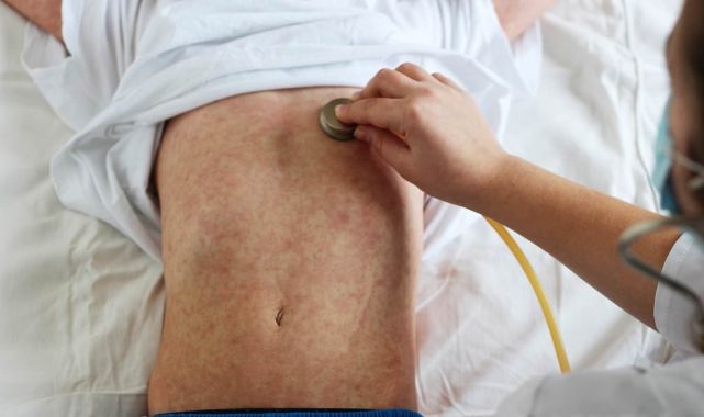 Where world's most infectious disease is spreading in US