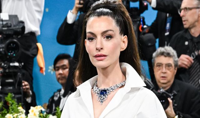 Anne Hathaway continues fueling plastic surgery rumors as fans react to her smooth new face at 2025 Met Gala