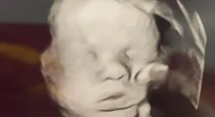'Hand of God' appears in ultrasound after mom prays for baby