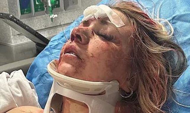 Bride reveals wedding transformation after bloody bachelorette attack