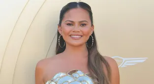 Chrissy Teigen, 39, bandaged face photo sparks concern