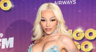 Doja Cat suffers plastic surgery disaster but begs fans not to notice