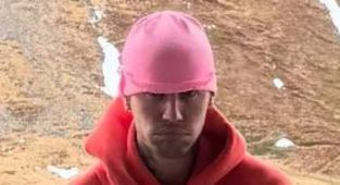 Glaring detail in Justin Bieber snaps sparks concerns over drug use