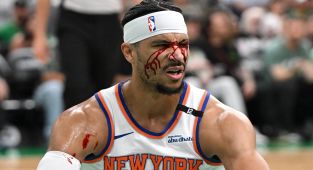 Knicks star gushes blood onto court in gruesome NBA playoff injury