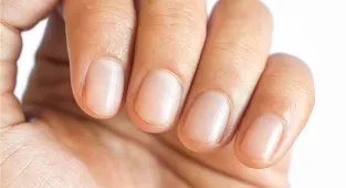 Little-known change to your fingers is early sign of deadly cancer