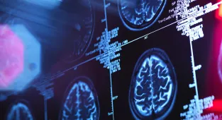 Mysterious explosion of brain diseases in city takes shocking twist