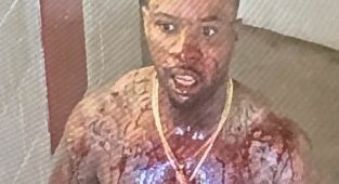 Pictures show Tory Lanez covered in blood after being stabbed 14 times