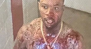 Pictures show Tory Lanez covered in blood after being stabbed 14 times