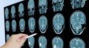 Scientists discover toxic substance hiding in 100% of people's brains
