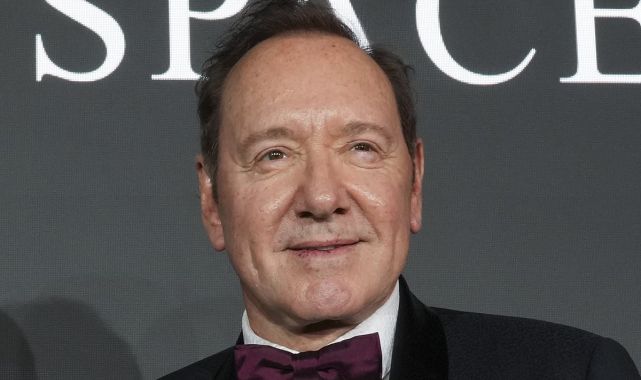 Two Hollywood face lifts: One's a masterpiece, the other a disaster...