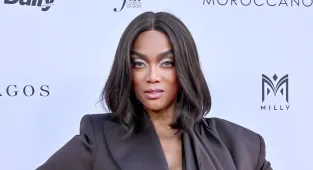 Tyra Banks' new face: Plastic surgeon weighs in on unrecognizable look