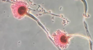 Deadly fungus that 'eats you from the inside out' invades US