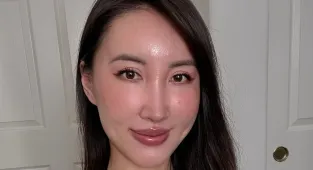I've had 14 plastic surgeries. I regret these common procedures