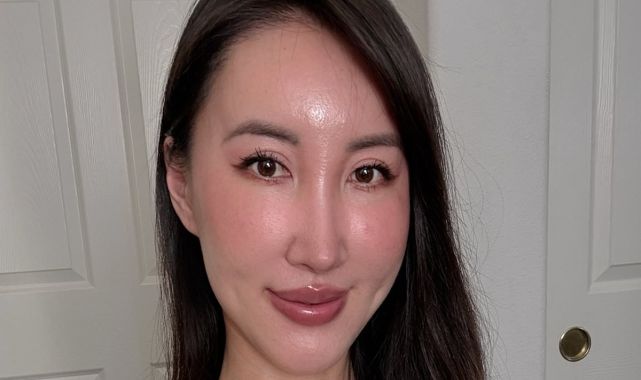 I've had 14 plastic surgeries. I regret these common procedures