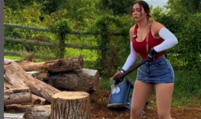 Model finds new passion after horrifying dog attack left her scarred