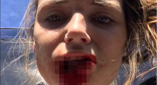 My ex bit off my lip in a rage - 7 years on I feel like a new woman