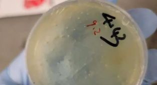 Third Chinese scientist charged with smuggling pathogen into US