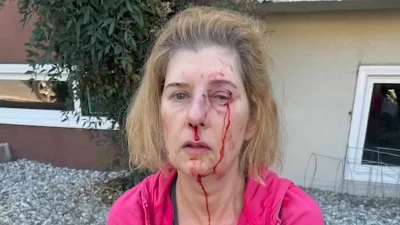 Distraught LA woman, 52, reveals horror of random homeless attack