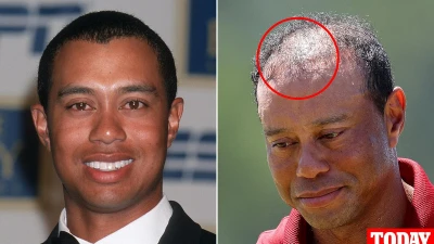 Doctor reveals rumored surgery Tiger Woods had that has failed TWICE