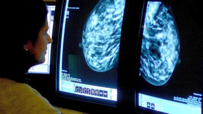 Doctors issue warning as common body type is linked to breast cancer