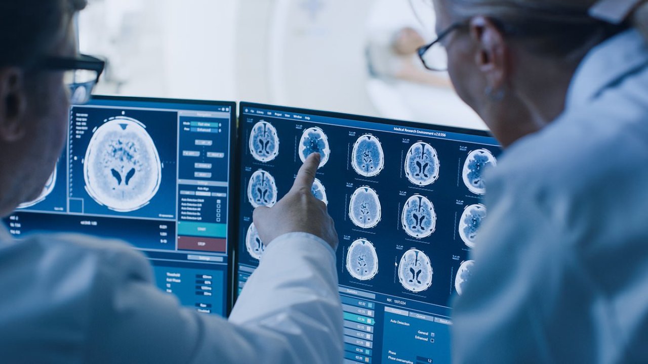 Four 'early warning patterns' that may help prevent dementia