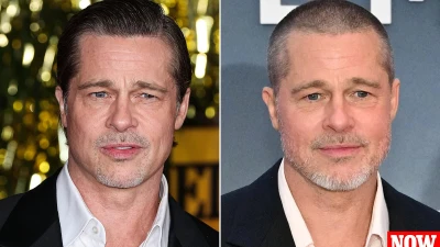 Secrets of ageless Brad Pitt's 'facelift' shared by plastic surgeons