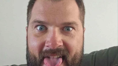 Victim of brutal golf fight involving ex-hockey star details injuries