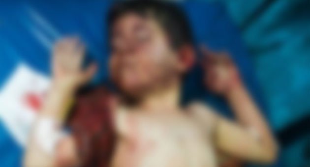 İdlib'e Hava Saldırısı 10 Ölü, Çok Sayıda Yaralı Var