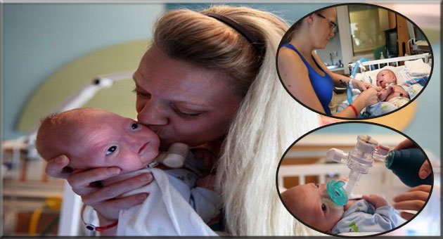 Mucize Bebek 'Eli' Burunsuz Doğdu