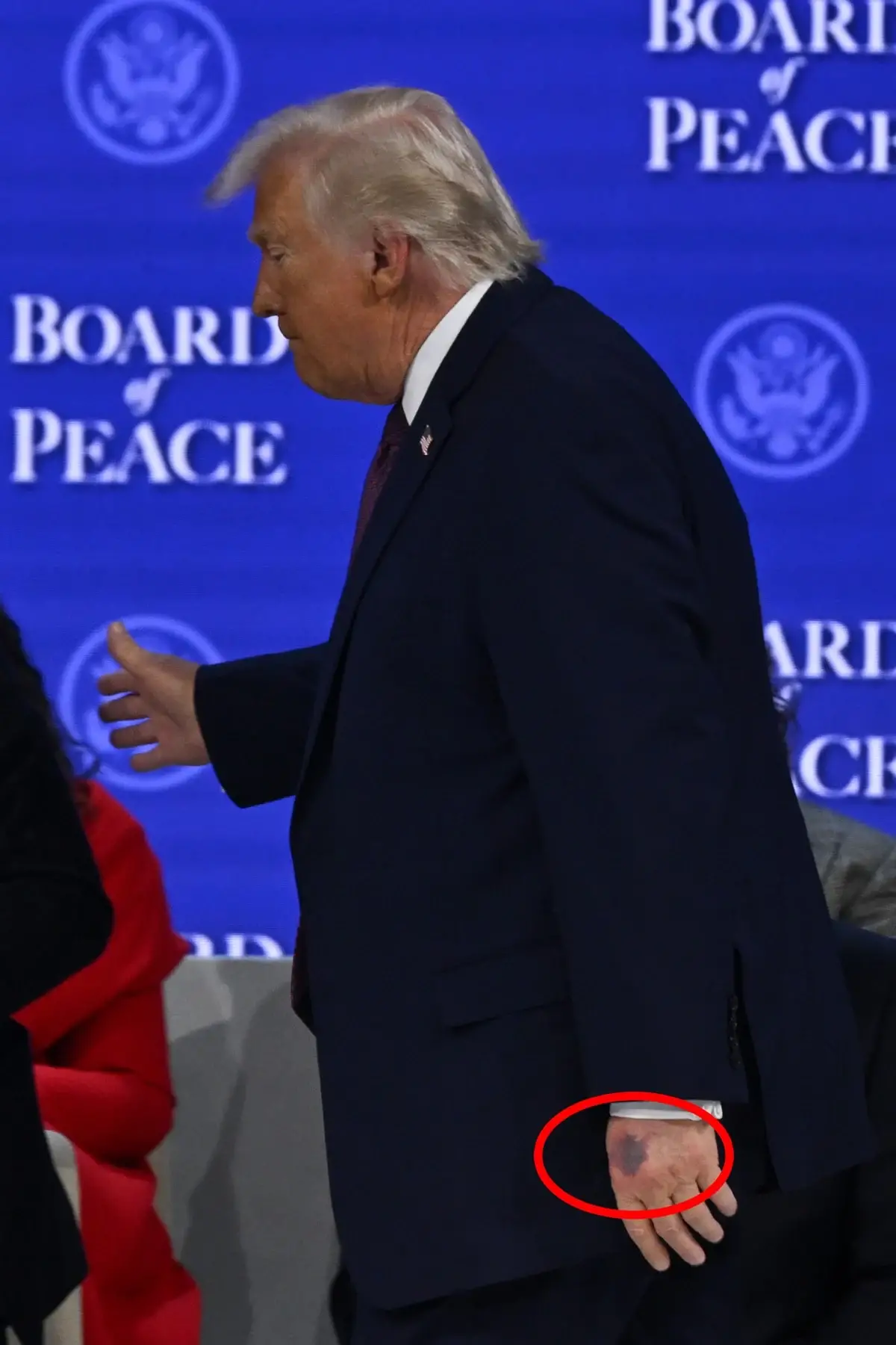 Trump’ın moraran eli yeniden tartışma yarattı