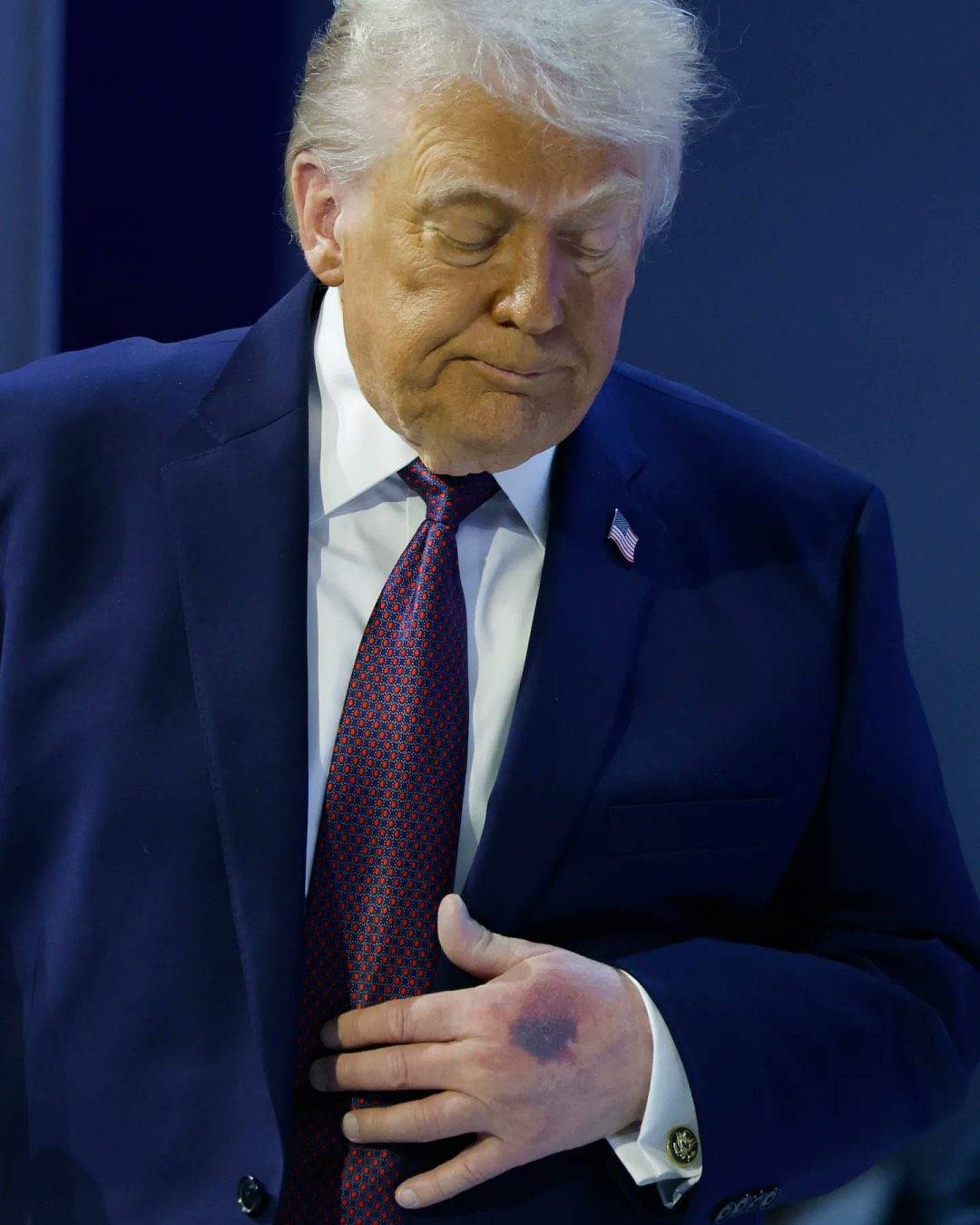 Trump’ın moraran eli yeniden tartışma yarattı