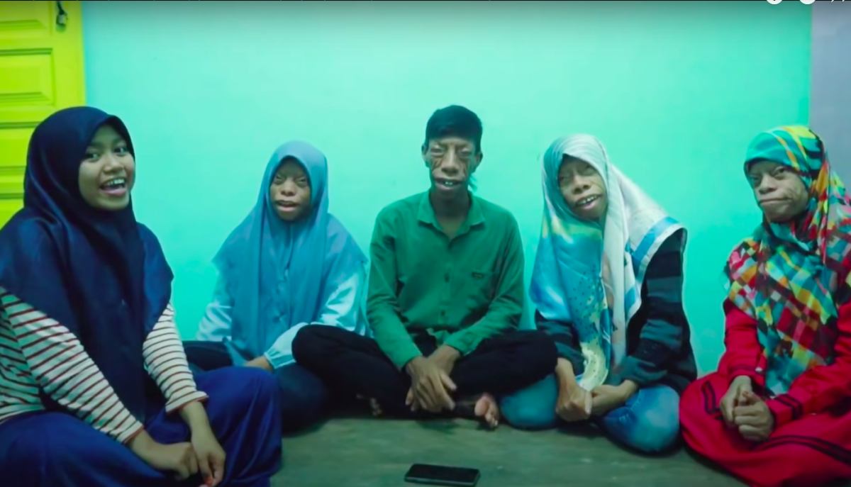 Endonezya’daki ‘Kertenkele ailesi’ gündem oldu